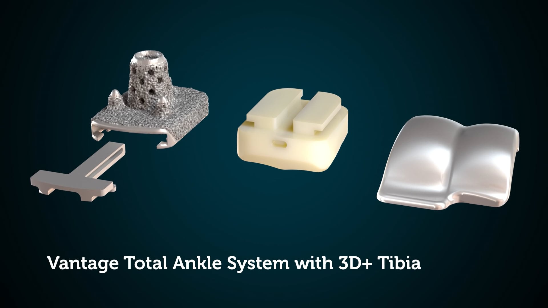 Vantage Total Ankle System with the Vantage Ankle 3D+ Tibia Surgical Animation