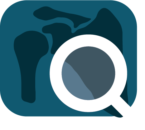 Advita Ortho Shoulder Technology Illustration