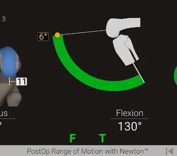 GPS Knee Newton Balancing Surgery PostOp Range of Motion Screen ROM