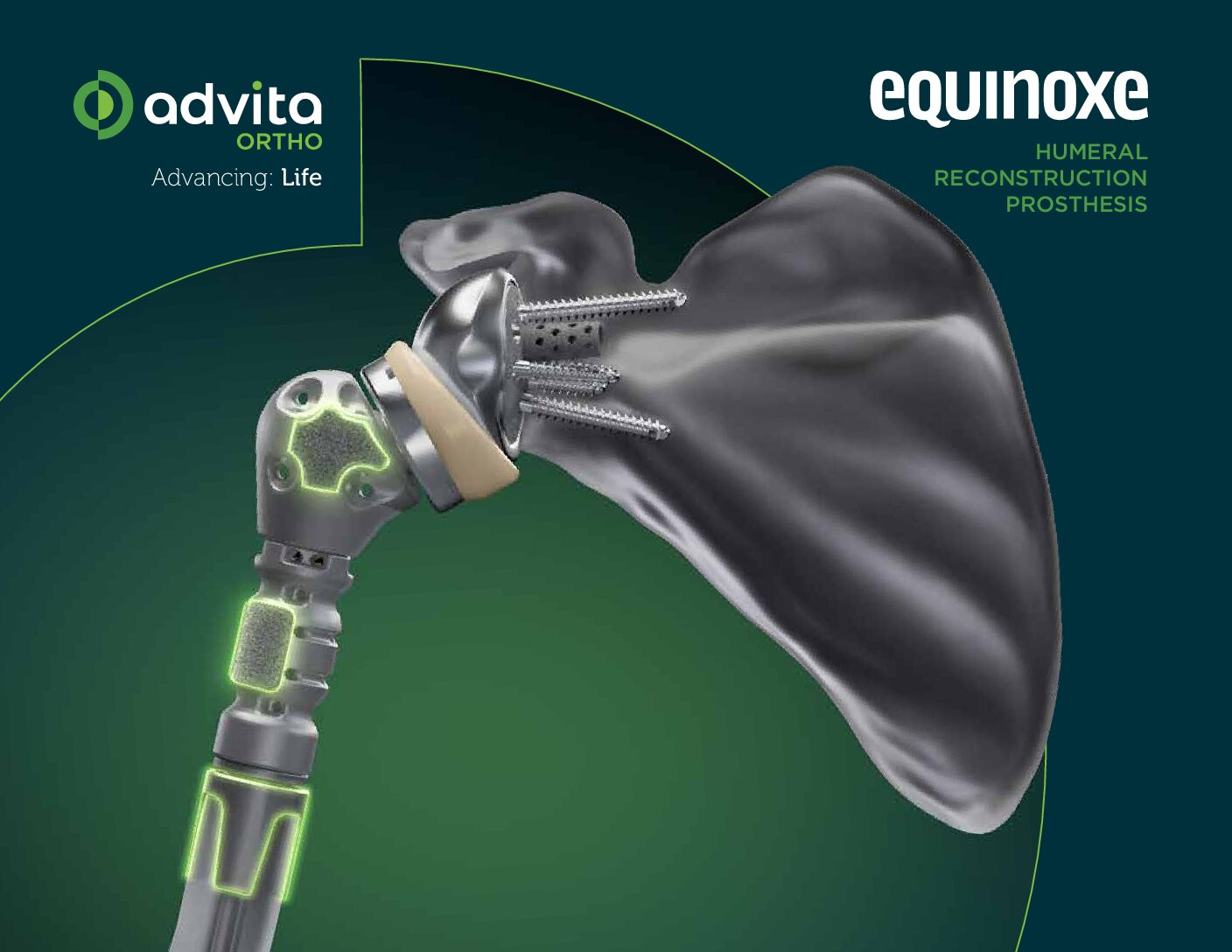 Equinoxe Humeral Reconstruction Prosthesis Design Rationale Summary